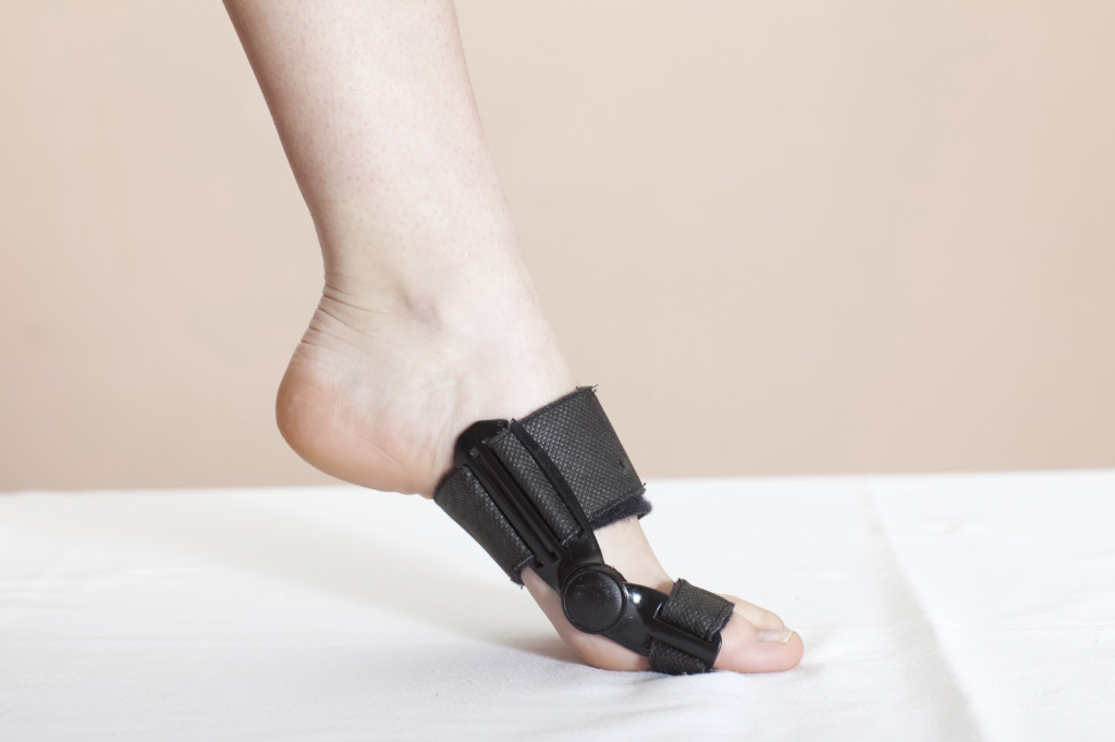 Foot injury (toe)