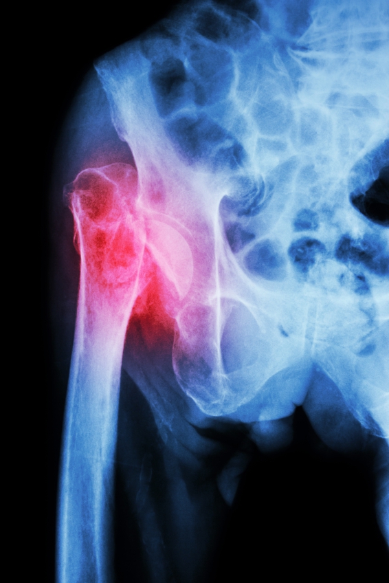 X-ray pelvis & hip joint 