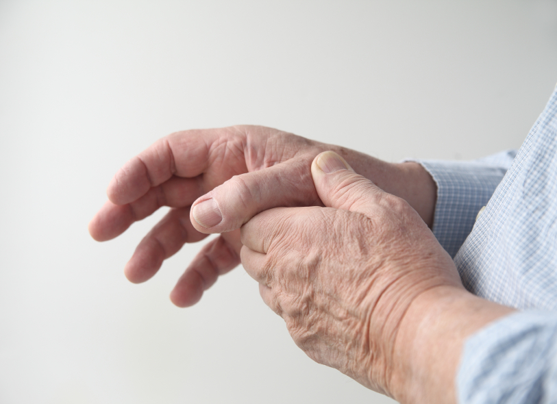 Managing Your Health: Living With Arthritis